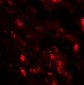 IL-36B Antibody